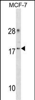 CDK2AP2 Antibody(Center)