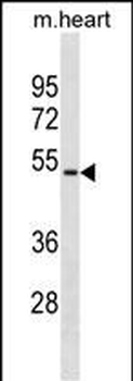 Mouse Hoxa10 Antibody(Center)
