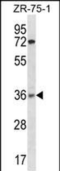 XRCC2 Antibody(N-term)