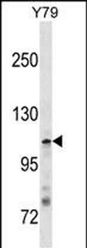 JMY Antibody(N-term)