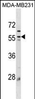 Mouse Plin3 Antibody(C-term)