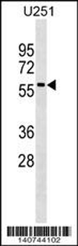 Rab9p40 Antibody (C-term)