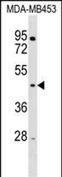 RNF128 Antibody (Center)