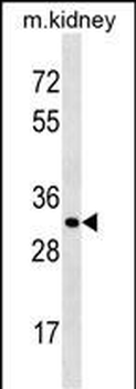 Mouse Ctsl1 Antibody (C-term)