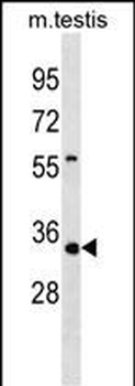 Mouse Tsta3 Antibody (C-term)