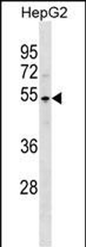 PKNOX1 Antibody (C-term)