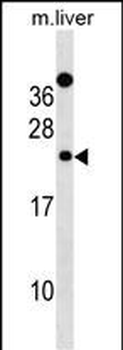 Mouse Derl2 Antibody (C-term)