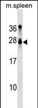 Mouse Tusc1 Antibody (Center)