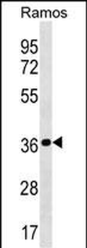 MRPL19 Antibody (N-term)