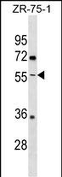 ENTPD5 Antibody (C-term)