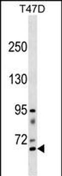 RHPN2 Antibody (Center)