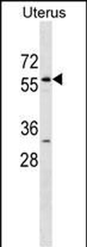 LEMD2 Antibody (N-term)