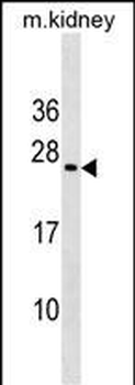 MIXL1 Antibody (Center)