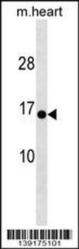 HIGD1C Antibody (C-term)