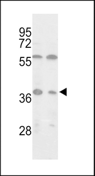 Isocitrate dehydrogenase (IDH3) Antibody (C-term)