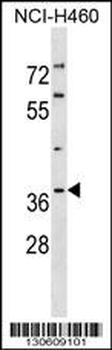 PIG3 Antibody (C-term)