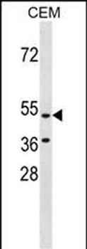 GPR109B Antibody (N-term)