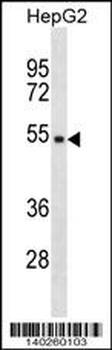 TMPPE Antibody (Center)