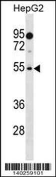 PRAMEF18 Antibody (Center)