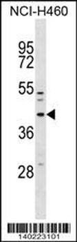 MFF Antibody (Center)