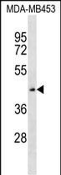 ZNF701 Antibody (Center)