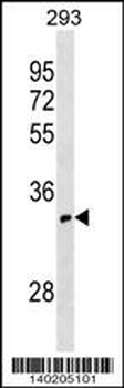OR52I1 Antibody (C-term)