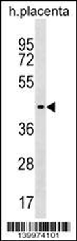 ZNF662 Antibody (C-term)