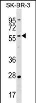 TAF6L Antibody (N-term)