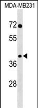 SNAPC3 Antibody (Center)