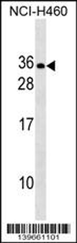 RLN2 Antibody (C-term)