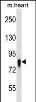 UBASH3A Antibody (Center)