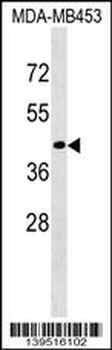 CD200R1L Antibody (N-term)