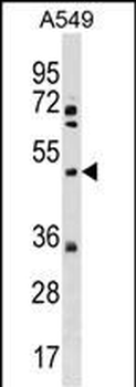 XK Antibody (N-term)