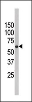 FUBP3 Antibody (N-term)