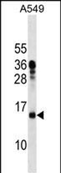 MRPL11 Antibody (N-term)