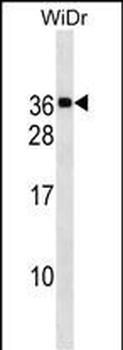 MED30 Antibody (Center)
