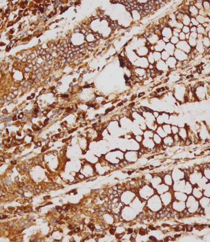 GATSL2 Antibody (N-term)