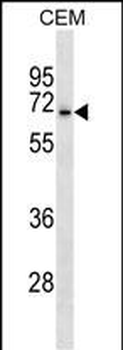 ACCN3 Antibody (N-term)