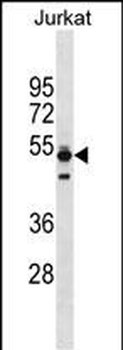 TMPO Antibody (Center)