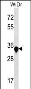 AMMECR1 Antibody (C-term)