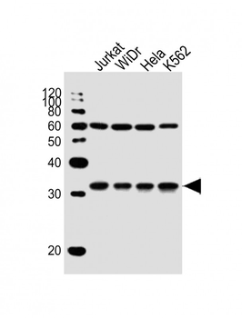 EXOSC6 Antibody (N-term)