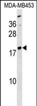 LYPLA1 Antibody (Center)