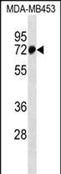 ZNF326 Antibody (N-term)