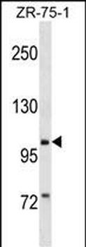 PIWIL2 Antibody (N-term)