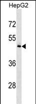 KHDRBS3 Antibody (N-term)