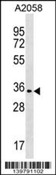 OR2T35 Antibody (C-term)