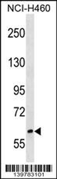 RREB1 Antibody (C-term)