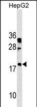 LBX2 Antibody (Center)