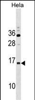 RPP14 Antibody (C-term)