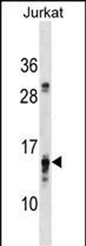 PFDN4 Antibody (N-term)